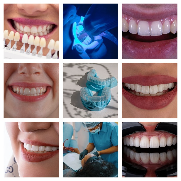 Patients Smiles